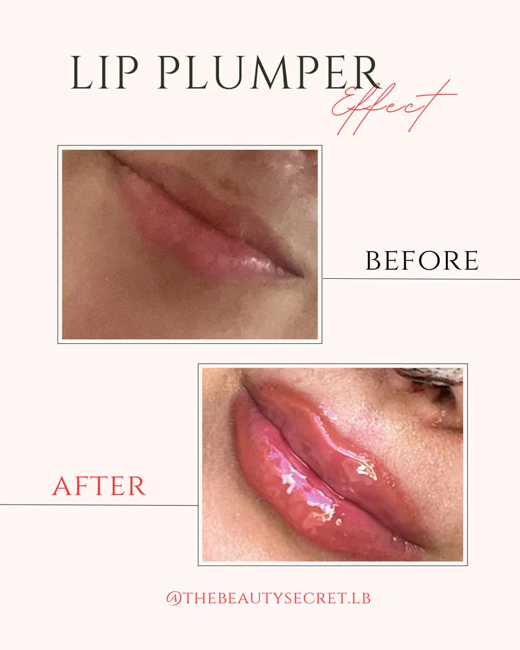 The Beauty Secret Lip Plumper